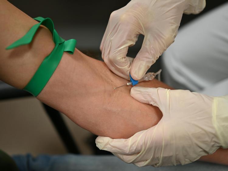 确诊三叉神经痛常用的检查项目说明