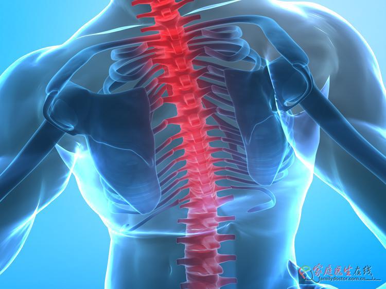 多发性骨髓瘤化疗：为何能缓解剧烈骨痛？ 治疗与康复 家医大健康 